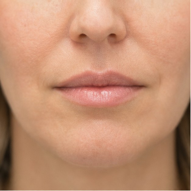 Lippen en het gebied rondom de mond