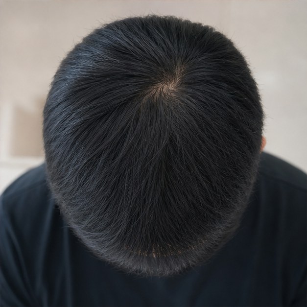Resultaat XL Hair behandeling 4