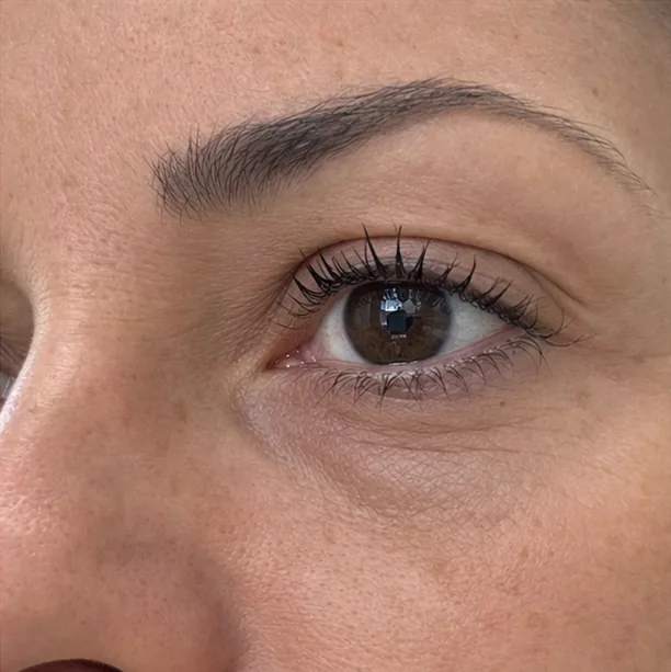 Indicatief resultaat RRS Eyes 1