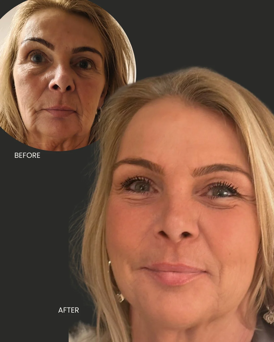 Voor-en-nafoto van Liquid Beauty