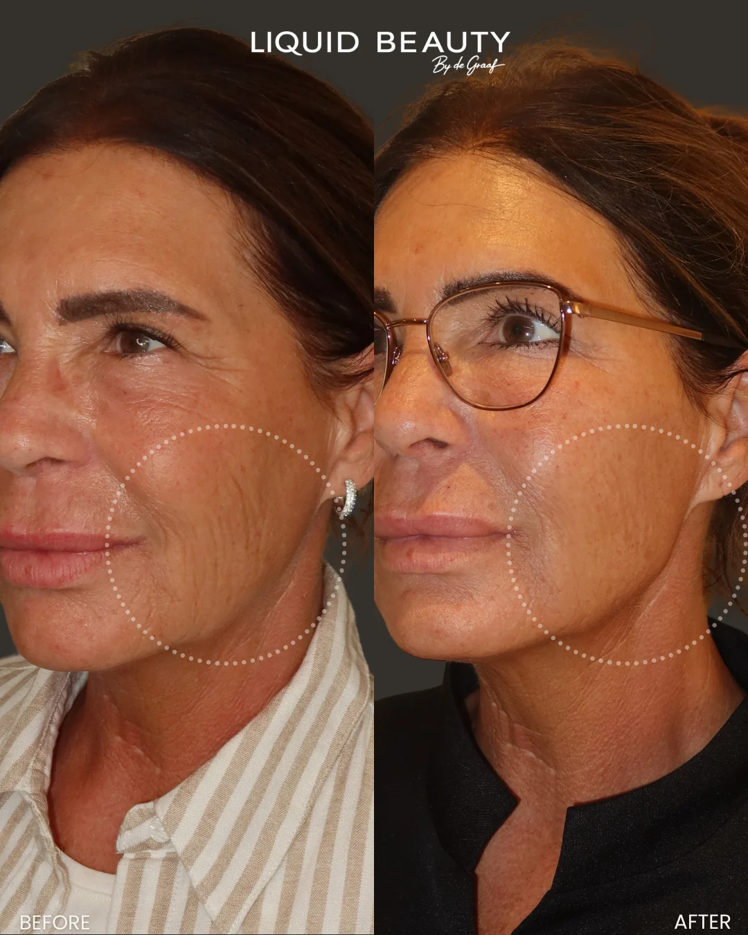 Voor-en-nafoto van Liquid Beauty