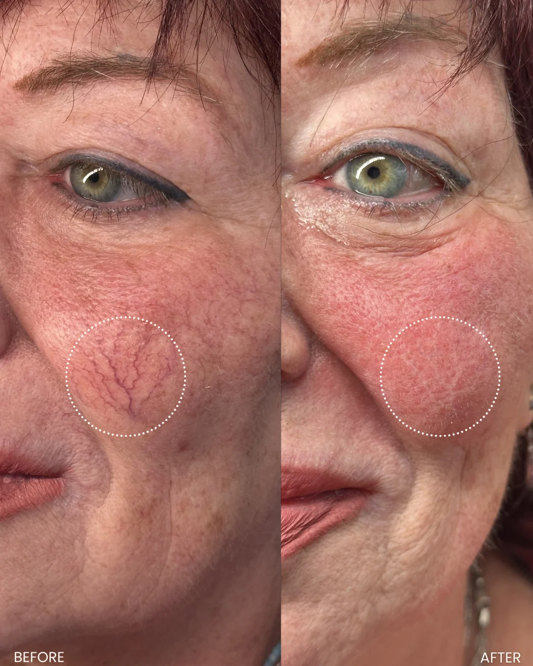 Voor-en-nafoto van Liquid Beauty